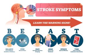 Image displaying the warning signs of having a stroke.